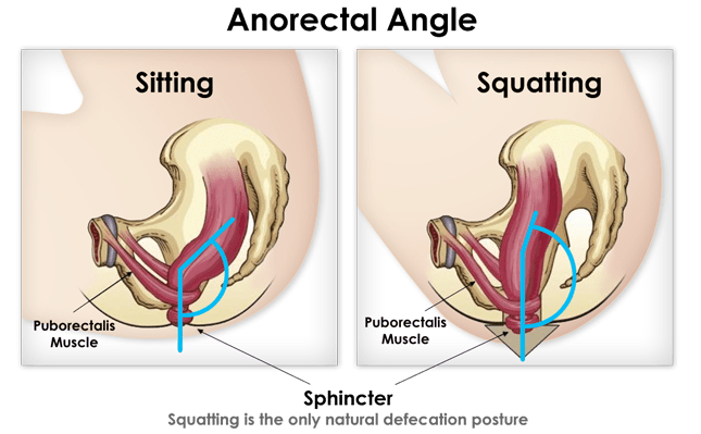 The Squatty Potty can help alleviate constipation. IBS-C is a common type of IBS.